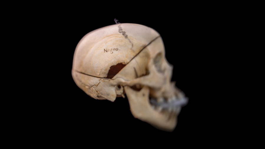 Skull Inscribed ‘Negro.’ Mütter Museum of the College of Physic